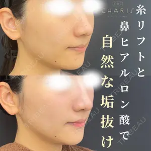 CHARIS BEAUTY CLINICの症例