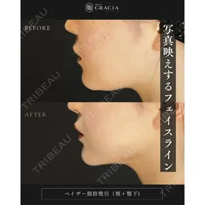 Casa de GRACIA GINZA 【カーサデグラシアギンザ】 樋口 隆男 理事長医師の症例