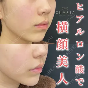 CHARIS BEAUTY CLINICの症例