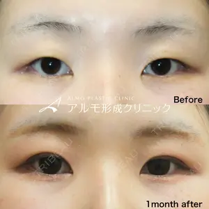 アルモ形成クリニックの症例