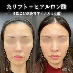 eクリニック 大阪院 脇谷 雄一朗医師の症例