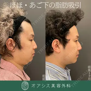 オアシス美容外科の症例