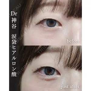 EMMO FACE CLINIC 大阪梅田院 神谷 一成医師の症例