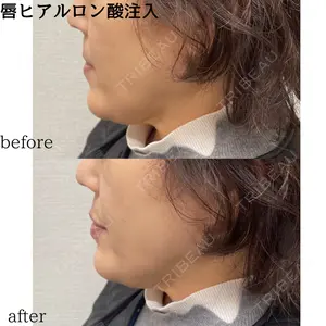 おおたかの森ビューティークリニックの症例