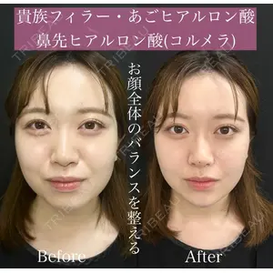 ルラ美容クリニック 渋谷本院 昼間 路子医師の症例
