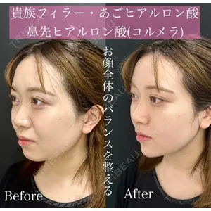 ルラ美容クリニック 渋谷本院 昼間 路子医師の症例