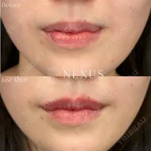 NEXUS CLINIC 岩井 勝矢医師の症例