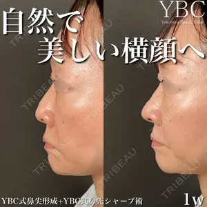 YBC横浜美容外科 立川院の症例