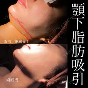 ヴェルトラクリニック 新宿院 伊藤　優医師の症例