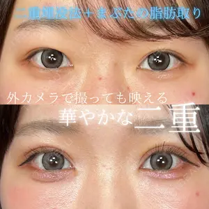 THE FIRST CLINIC 多摩センター院 惟村 公郁医師の症例