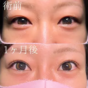 HAAB×DREAM BEAUTY CLINIC 大阪梅田院 鈴木 馨斗医師の症例