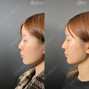 R Beauty CLINIC 名古屋院 木村 尚大医師の症例