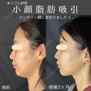 ルラ美容クリニック 仙台院 橋本 英樹医師の症例