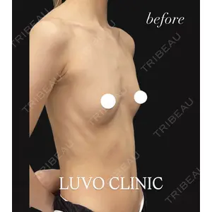 LUVO CLINIC TOKYOの症例