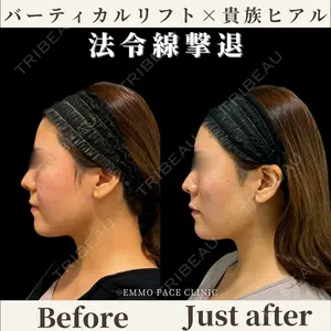 EMMO FACE CLINIC 東京三田院 木之下 哲彦医師の症例