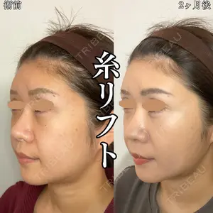 形成外科と美容外科のクリニック池袋 春日 航医師の症例
