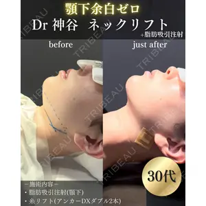 EMMO FACE CLINIC 大阪梅田院 神谷 一成医師の症例