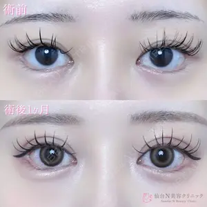仙台N美容クリニック 小阪 捺稀医師の症例
