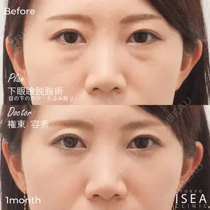 東京イセアクリニック 権東　容秀医師の症例