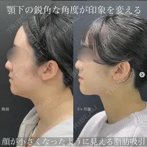 湘南美容クリニック 名古屋駅本院 豊嶋 沙良医師の症例