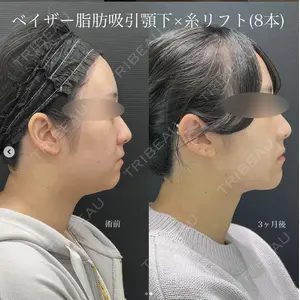 湘南美容クリニック 名古屋駅本院 豊嶋 沙良医師の症例