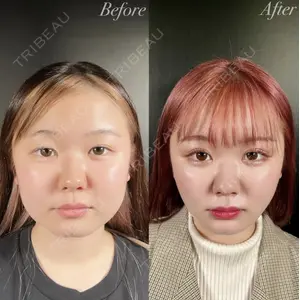 R Beauty CLINIC 銀座院 中西 友莉医師の症例