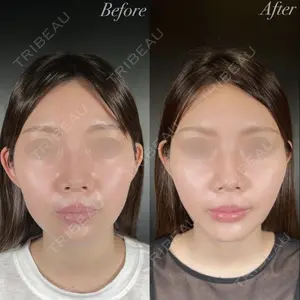 R Beauty CLINIC 銀座院 中西 友莉医師の症例