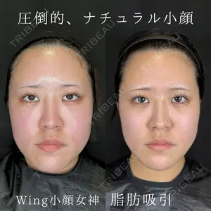 Wing clinic 豊中駅前院 速水 翼医師の症例