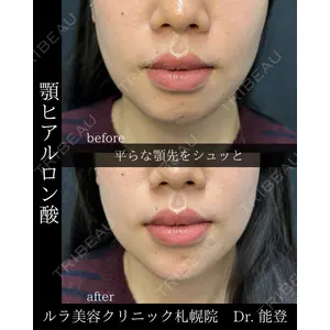 ルラ美容クリニック 札幌院 能登 貴弘医師の症例