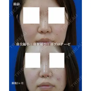 リッツ美容外科 大阪院の症例