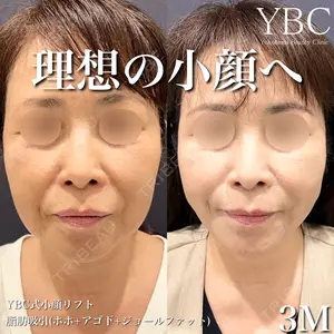 YBC横浜美容外科 大宮院 磯村 亮輔医師の症例