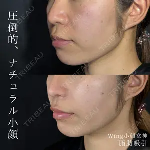 Wing clinic 豊中駅前院 速水 翼医師の症例