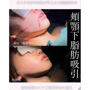 ヴェルトラクリニック 新宿院 伊藤　優医師の症例