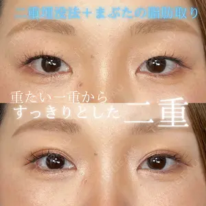 THE FIRST CLINIC 多摩センター院 惟村 公郁医師の症例