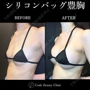Code Beauty Clinic 名古屋院 橋本 祥平医師の症例
