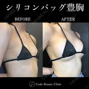 Code Beauty Clinic 名古屋院 橋本 祥平医師の症例