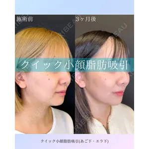 ルラ美容クリニック 札幌院 佐藤 雄紀医師の症例
