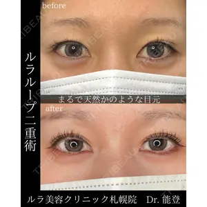ルラ美容クリニック 札幌院 能登 貴弘医師の症例