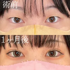 HAAB×DREAM BEAUTY CLINIC 大阪梅田院 柏木 太雅医師の症例