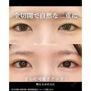 シンデレラ＆ダヴィンチクリニック 宮田 洋佑医師の症例