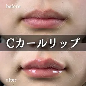 ルラ美容クリニック 新宿院 陶 美梨医師の症例