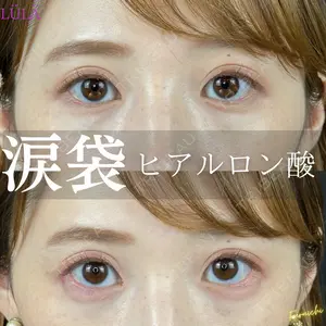 ルラ美容クリニック 新宿院 古市 まり江医師の症例