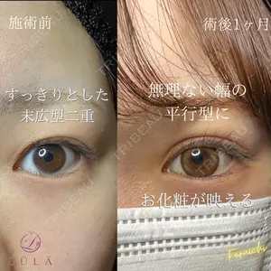 ルラ美容クリニック 新宿院の症例