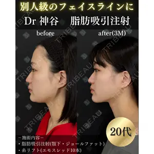 EMMO FACE CLINIC 大阪梅田院 神谷 一成医師の症例