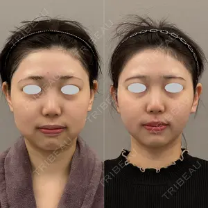 ARIEL.BUST.CLINIC 石塚 紀行医師の症例