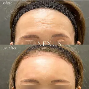 NEXUS CLINIC 岩井 勝矢医師の症例
