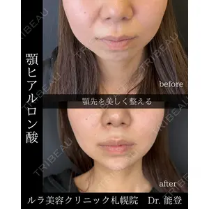 ルラ美容クリニック 札幌院 能登 貴弘医師の症例
