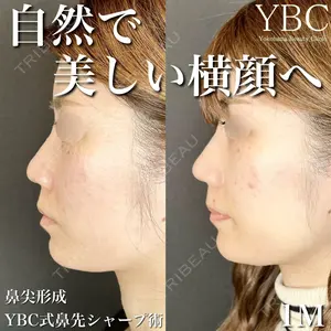YBC横浜美容外科 大宮院 磯村 亮輔医師の症例