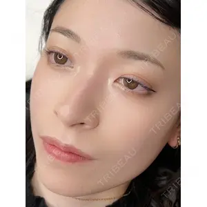 インクリニック 大塚 はるか医師の症例