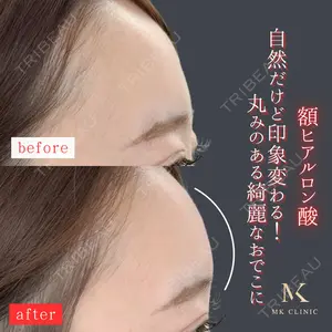 MKクリニック 日本橋院 石田雄太郎医師の症例